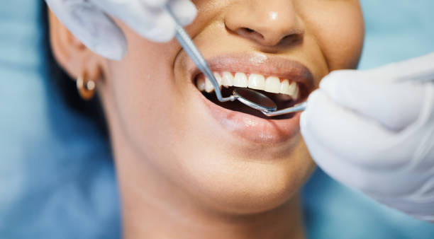 Best Emergency Dental Extractions in Madisonville, TX