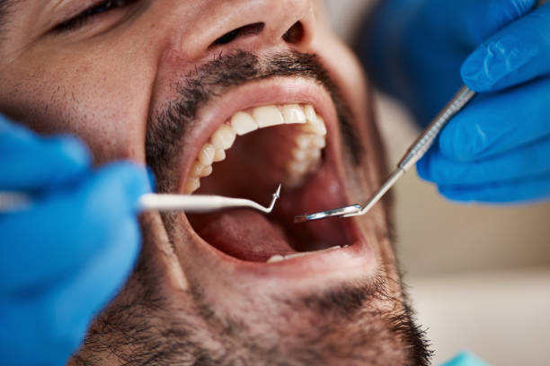 Best Emergency Dental Services for Seniors in Madisonville, TX